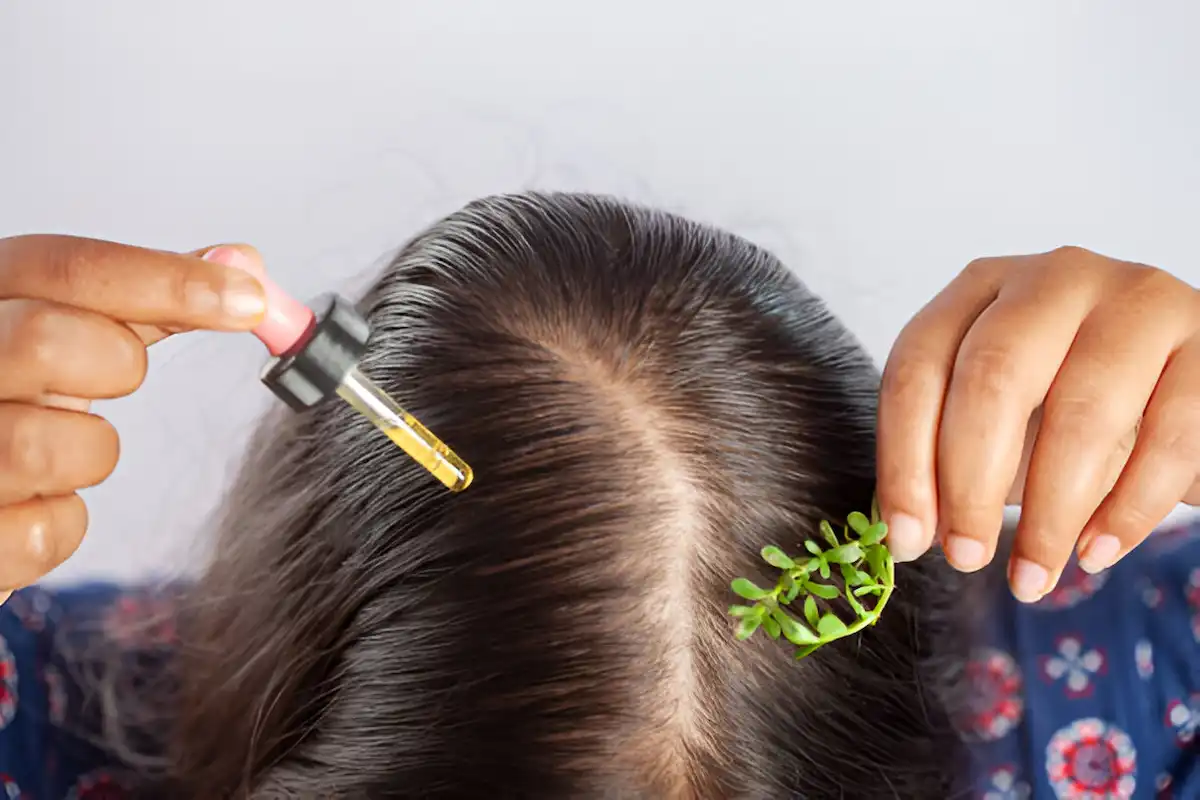 Rosemary oil for dandruff